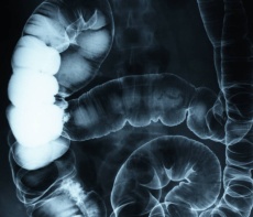 GASTRO LAPARO CARE ONCOCARE 